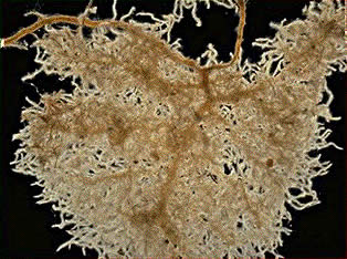 Proteoid cluster roots of a banksia plant